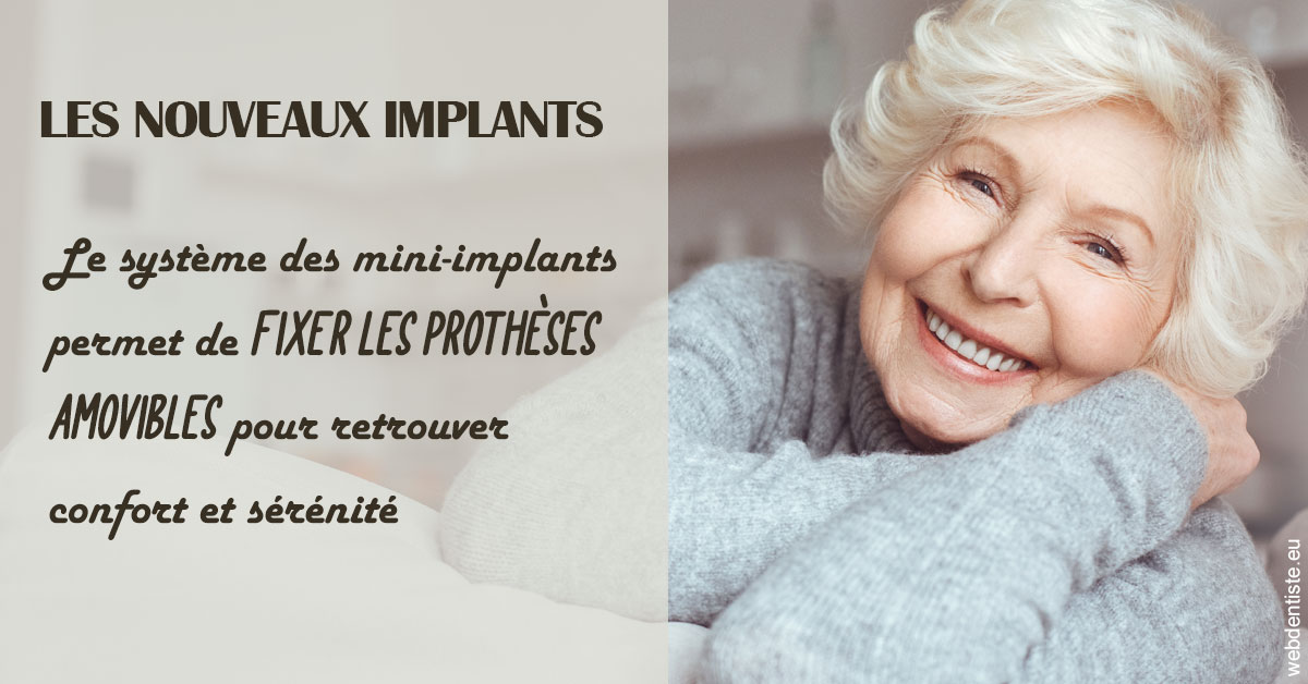 https://dr-guillemant-hubert.chirurgiens-dentistes.fr/Les nouveaux implants 1