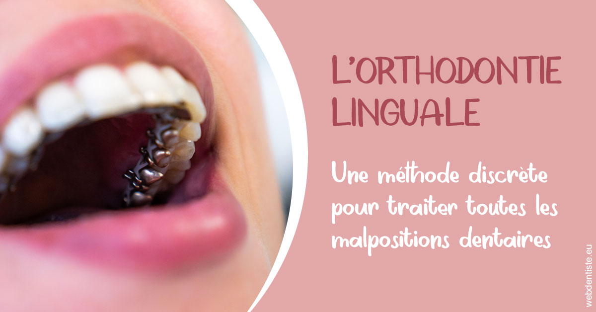 https://dr-guillemant-hubert.chirurgiens-dentistes.fr/L'orthodontie linguale 2