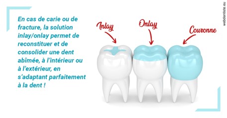 https://dr-guillemant-hubert.chirurgiens-dentistes.fr/L'INLAY ou l'ONLAY