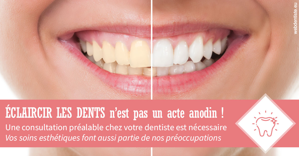https://dr-guillemant-hubert.chirurgiens-dentistes.fr/Eclaircir les dents 1