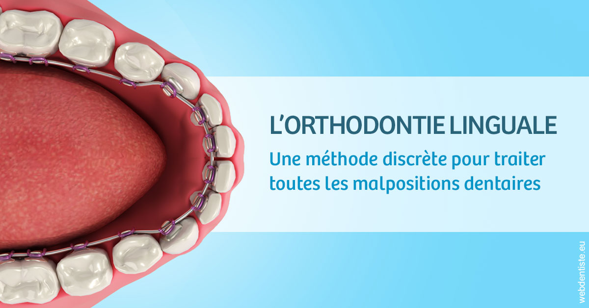 https://dr-guillemant-hubert.chirurgiens-dentistes.fr/L'orthodontie linguale 1
