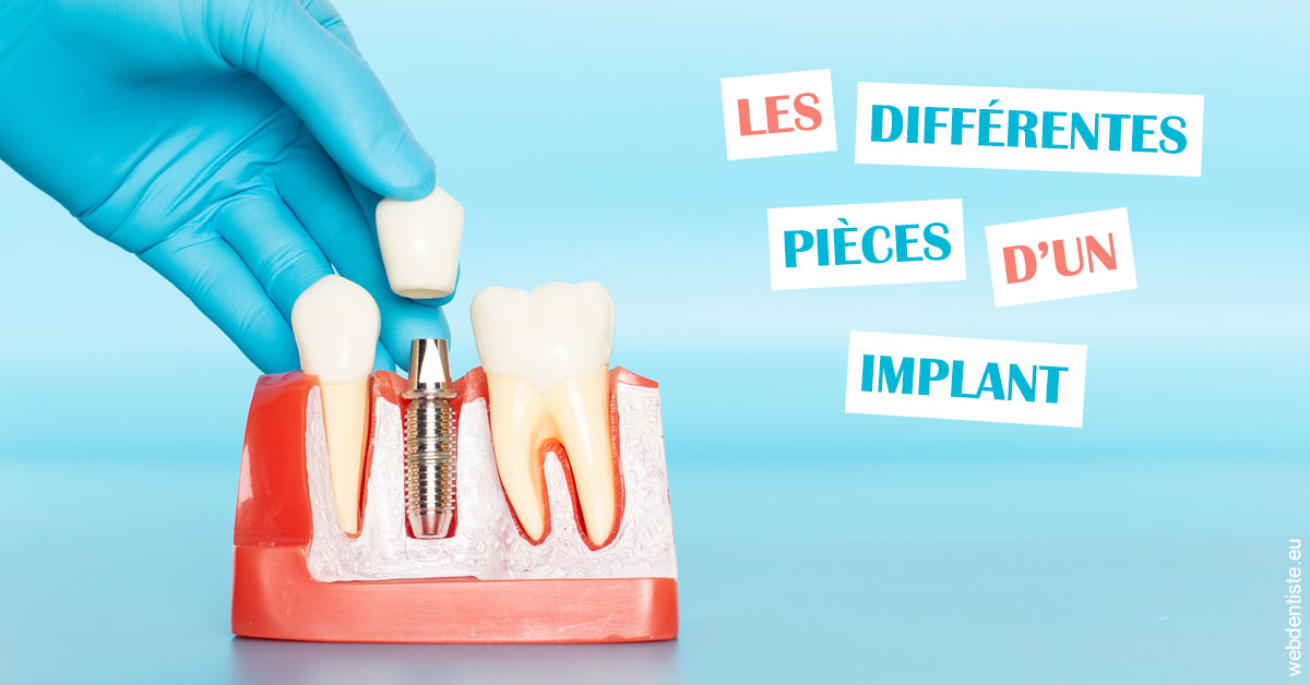 https://dr-guillemant-hubert.chirurgiens-dentistes.fr/Les différentes pièces d’un implant 2