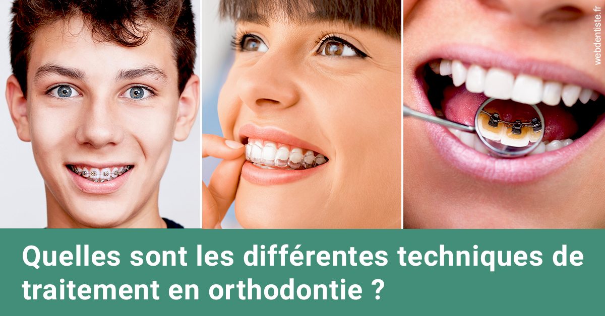 https://dr-guillemant-hubert.chirurgiens-dentistes.fr/Les différentes techniques de traitement 2