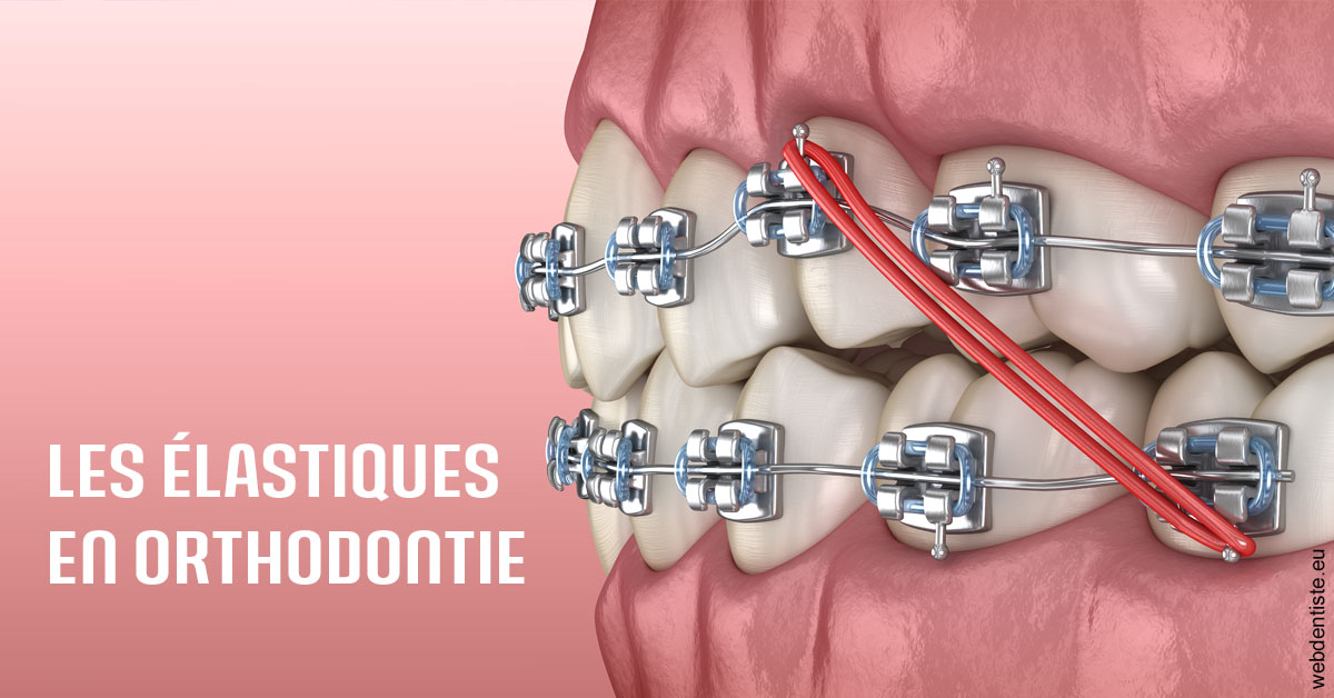 https://dr-guillemant-hubert.chirurgiens-dentistes.fr/Elastiques orthodontie 2