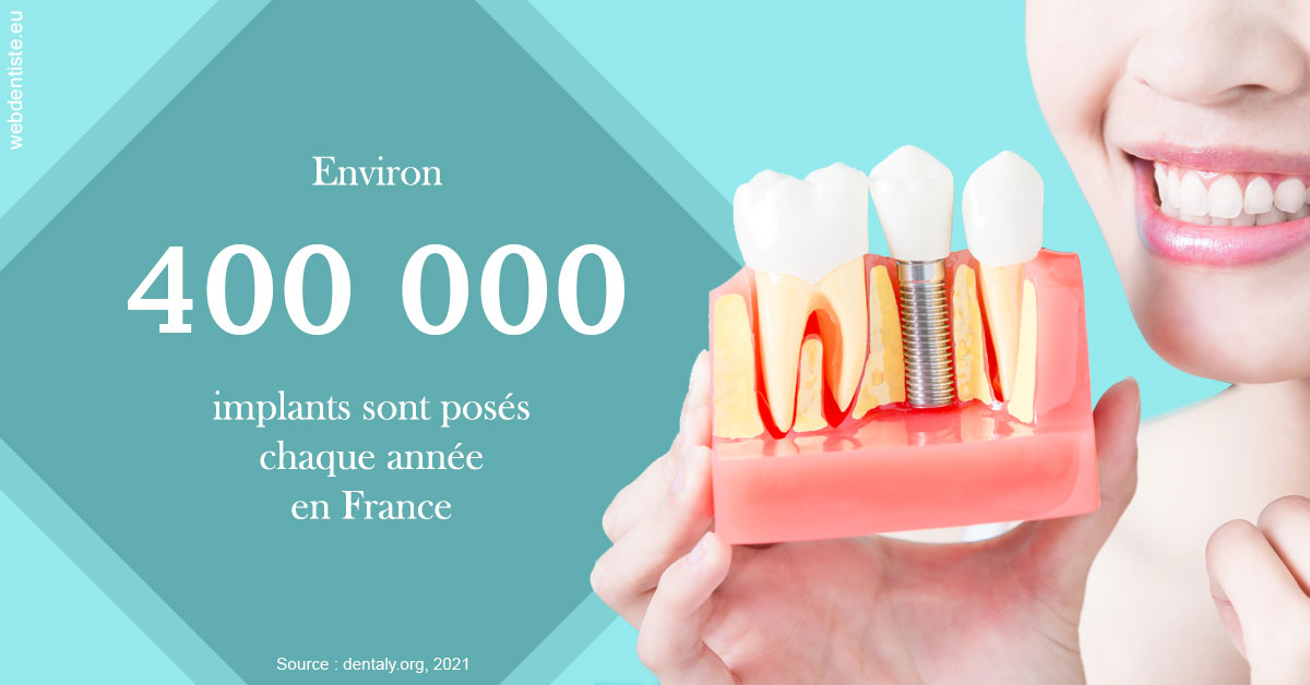 https://dr-guillemant-hubert.chirurgiens-dentistes.fr/Pose d'implants en France 2